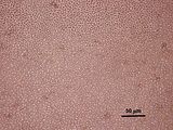 7 – Cellule corticali in visione superficiale